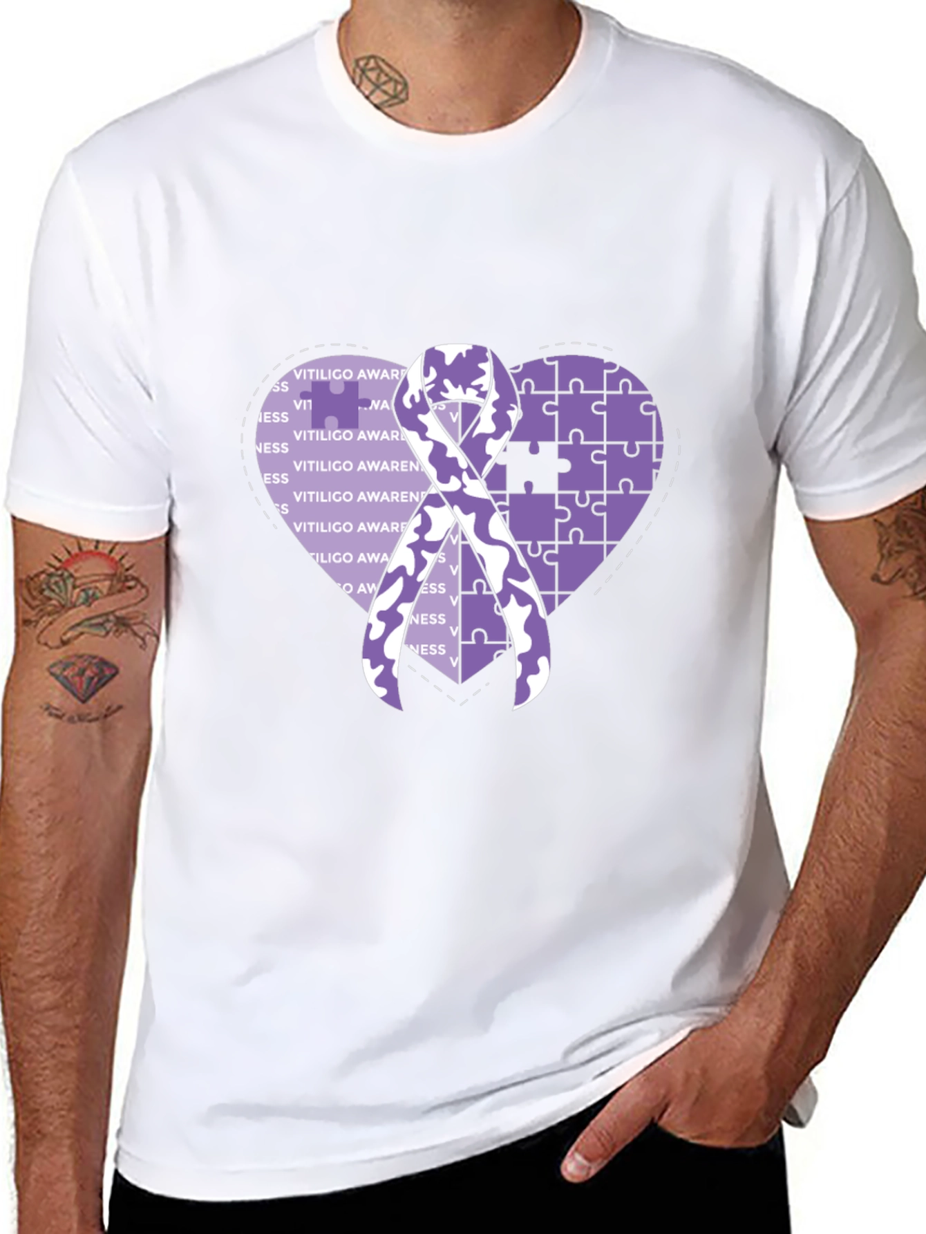 Vitiligo Awareness T-Shirt