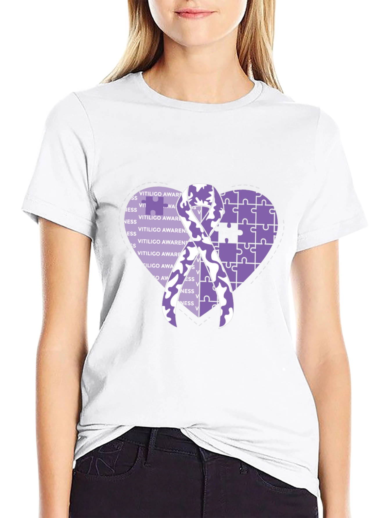 Vitiligo Awareness T-Shirt